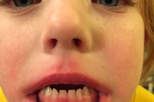 Losing Your First Baby Tooth
